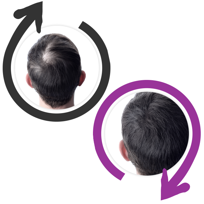 crema anti ostruzione dei pori